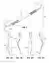 Fig. 02 - PERIODONTAL SCALER