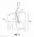 Fig. 03 - PERIODONTAL SCALER