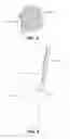 Fig. 04 - PERIODONTAL SCALER