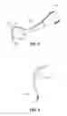Fig. 04 - AREA-SPECIFIC DENTAL INSTRUMENT
