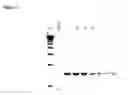 Fig. 03 - Compositions and Methods for Detecting Pathogen Specific Nucleic Acids in Urine