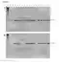 Fig. 04 - Compositions and Methods for Detecting Pathogen Specific Nucleic Acids in Urine