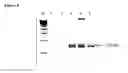 Fig. 06 - Compositions and Methods for Detecting Pathogen Specific Nucleic Acids in Urine