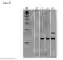 Fig. 11 - Compositions and Methods for Detecting Pathogen Specific Nucleic Acids in Urine
