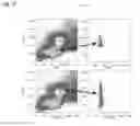 Fig. 16 - Method of assaying an individual for immune impairment