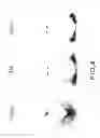 Fig. 04 - DOPAMINERGIC NEURON PROLIFERATIVE PROGENITOR CELL MARKER Nato3