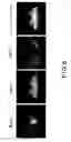 Fig. 05 - DOPAMINERGIC NEURON PROLIFERATIVE PROGENITOR CELL MARKER Nato3