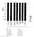 Fig. 06 - DOPAMINERGIC NEURON PROLIFERATIVE PROGENITOR CELL MARKER Nato3
