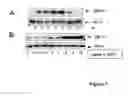 Fig. 04 - Phosphorylated NF45 Biomarkers, Antibodies And Methods Of Using Same