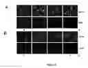 Fig. 05 - Phosphorylated NF45 Biomarkers, Antibodies And Methods Of Using Same