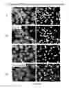 Fig. 03 - METHOD FOR TREATING B CELL REGULATED AUTOIMMUNE DISORDERS