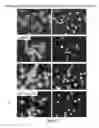 Fig. 04 - METHOD FOR TREATING B CELL REGULATED AUTOIMMUNE DISORDERS