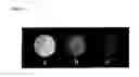 Fig. 04 - METHODS FOR MAGNETIC RESONANCE IMAGING