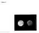 Fig. 06 - METHODS FOR MAGNETIC RESONANCE IMAGING