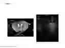 Fig. 46 - METHODS FOR MAGNETIC RESONANCE IMAGING