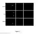 Fig. 03 - METHODS FOR ISOLATING VERY SMALL EMBRYONIC-LIKE (VSEL) STEM CELLS