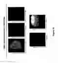 Fig. 16 - METHODS FOR ISOLATING VERY SMALL EMBRYONIC-LIKE (VSEL) STEM CELLS