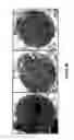 Fig. 34 - METHODS FOR ISOLATING VERY SMALL EMBRYONIC-LIKE (VSEL) STEM CELLS