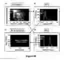 Fig. 74 - METHODS FOR ISOLATING VERY SMALL EMBRYONIC-LIKE (VSEL) STEM CELLS