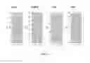 Fig. 02 - Methods of detecting and treating pulmonary disease and markers thereof