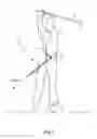 Fig. 03 - Golf swing training device for correcting arm position and hip rotation sequence