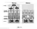 Fig. 18 - METHODS AND SYSTEMS TO DIAGNOSE A CONDITION IN AN INDIVIDUAL