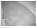 Fig. 01 - Method of diagnosing esophageal cancer