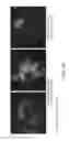 Fig. 21 - Surface display of whole antibodies in eukaryotes