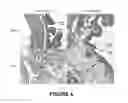 Fig. 05 - Methods for treating interstitial cystitis