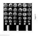 Fig. 18 - Methods for preventing or treating mitochondrial permeability transition