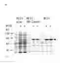 Fig. 02 - Methods of using vimentin to inhibit angiogenesis and endothelial cell proliferation