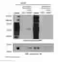 Fig. 06 - Methods of using vimentin to inhibit angiogenesis and endothelial cell proliferation