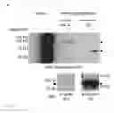 Fig. 09 - Methods of using vimentin to inhibit angiogenesis and endothelial cell proliferation