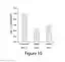 Fig. 13 - Compositions and methods for diagnosis and prognosis of cancer and progression, and for screening anti-cancer agents