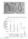 Fig. 03 - Cancer antigen eEF2