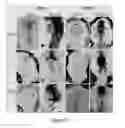 Fig. 06 - METHOD AND COMPOSITION FOR MODULATING CANONICAL WNT PATHWAY USING FOLATE AND INOSITOL