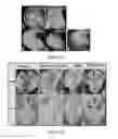 Fig. 19 - METHOD AND COMPOSITION FOR MODULATING CANONICAL WNT PATHWAY USING FOLATE AND INOSITOL