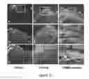 Fig. 22 - METHOD AND COMPOSITION FOR MODULATING CANONICAL WNT PATHWAY USING FOLATE AND INOSITOL
