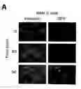 Fig. 01 - METHODS AND COMPOSITIONS FOR EXTENDING THE LIFE SPAN AND INCREASING THE STRESS RESISTANCE OF CELLS AND ORGANISMS