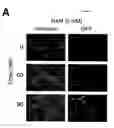 Fig. 11 - METHODS AND COMPOSITIONS FOR EXTENDING THE LIFE SPAN AND INCREASING THE STRESS RESISTANCE OF CELLS AND ORGANISMS
