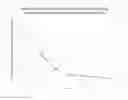 Fig. 01 - Rapid onset liquid midazolam composition for buccal administration