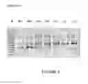Fig. 07 - Antisense oligonucleotides for inducing exon skipping and methods of use thereof