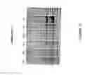 Fig. 20 - Antisense oligonucleotides for inducing exon skipping and methods of use thereof