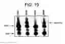 Fig. 17 - CELLS FOR INCREASED PROTEIN EXPRESSION COMPRISING ONE OR MORE RELEASE FACTORS AND METHODS OF USE