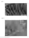 Fig. 03 - COLLAGEN IMPLANT