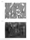 Fig. 04 - COLLAGEN IMPLANT