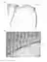 Fig. 07 - COLLAGEN IMPLANT