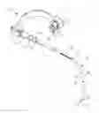 Fig. 01 - GASTRIC RING WITH A FITTING ROD