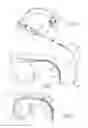 Fig. 02 - GASTRIC RING WITH A FITTING ROD
