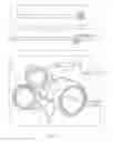 Fig. 09 - Systems and Methods for Optimizing and Maintaining Visualization of a Surgical Field During the Use of Surgical Scopes